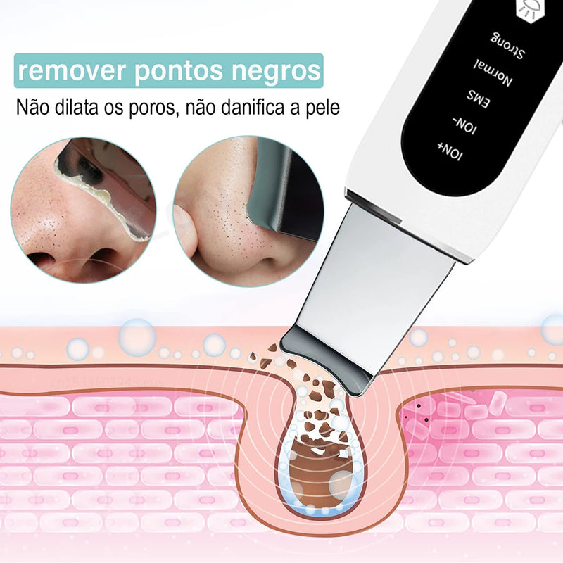 Ultrasonic Skin Scrubber Peeling Blackhead Remover Deep Face Cleaning Ultrasonic Ion Ance Pore Cleaner Facial Shovel Cleanser